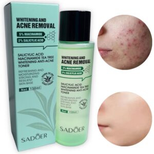 Tonico Blanqueador Antiacne sadoer 130 ml